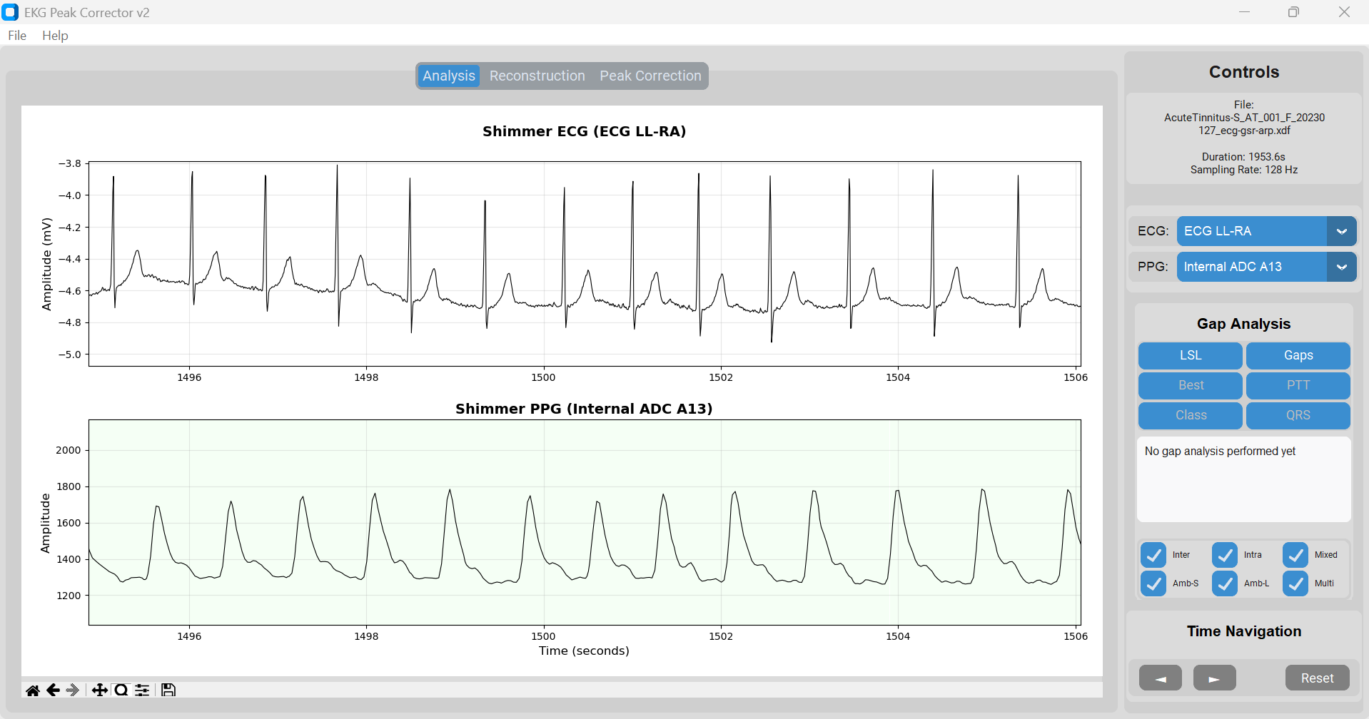 EKG Peak Corrector Tool